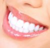HOW TO STRAIGHTEN TEETH AT HOME EASILY WITHOUT BRACES